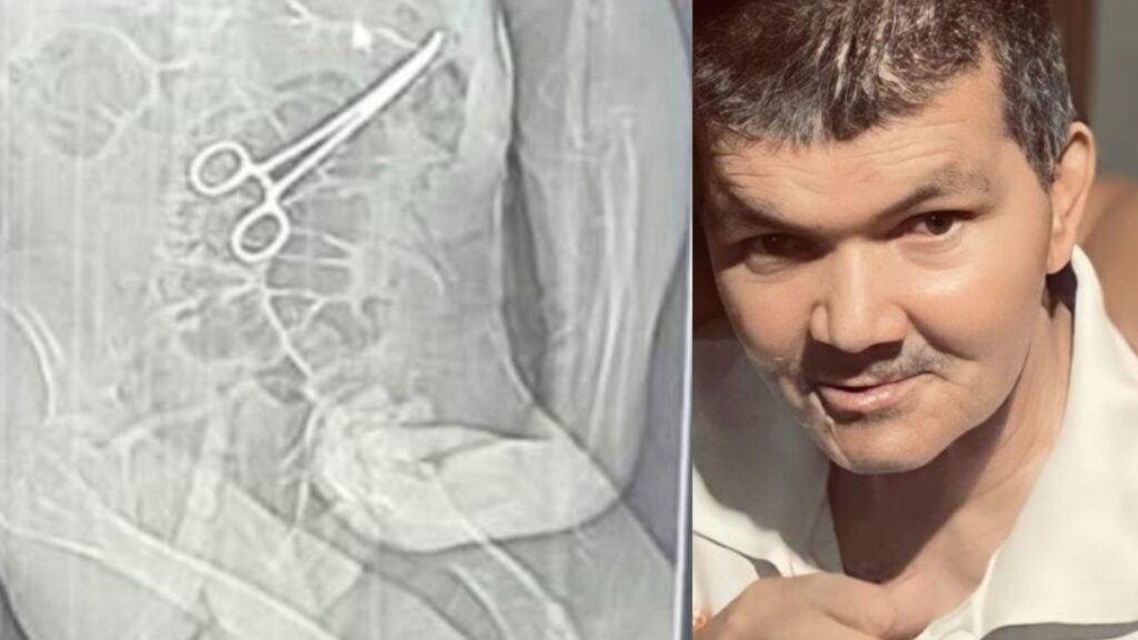 Exoneração de Médicos após Cirurgia que Resultou em Morte de Idoso em MG