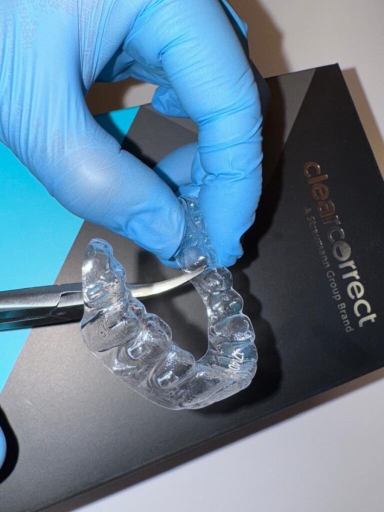 Técnica Híbrida: A Solução Eficiente na Ortodontia Moderna