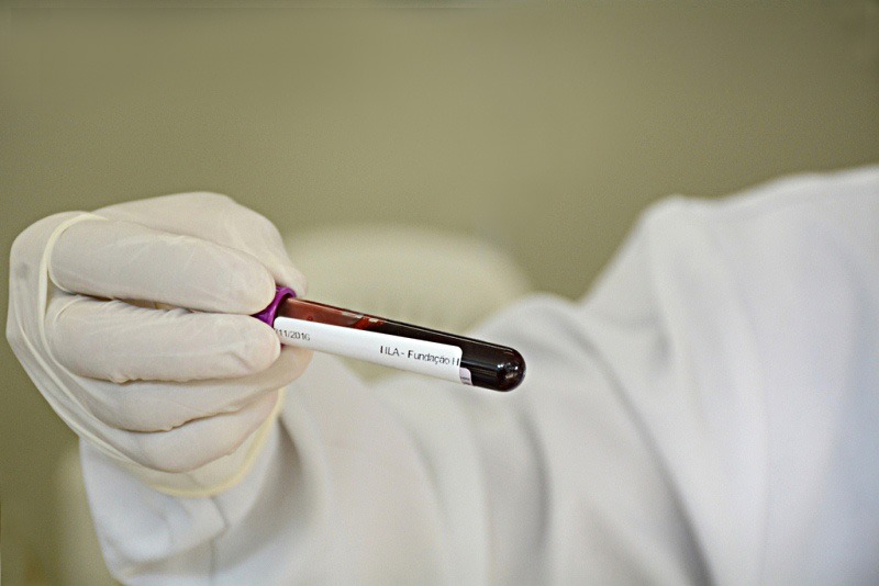 Governo de Minas Facilita Acesso a Resultados de Exames de Doador de Sangue no MG App Governo de Minas Facilita Acesso a Resultados de Exames de Doador de Sangue no MG App